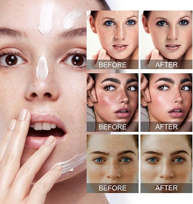 🔥 Eelhoe Dark Spot Remover Cream (Original)