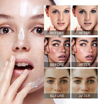 🔥 Eelhoe Dark Spot Remover Cream (Original)