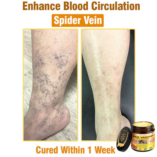 South Moon Bee Venom Pain Relief Cream for Arthritis, Muscle & Joint Discomfort (Original)